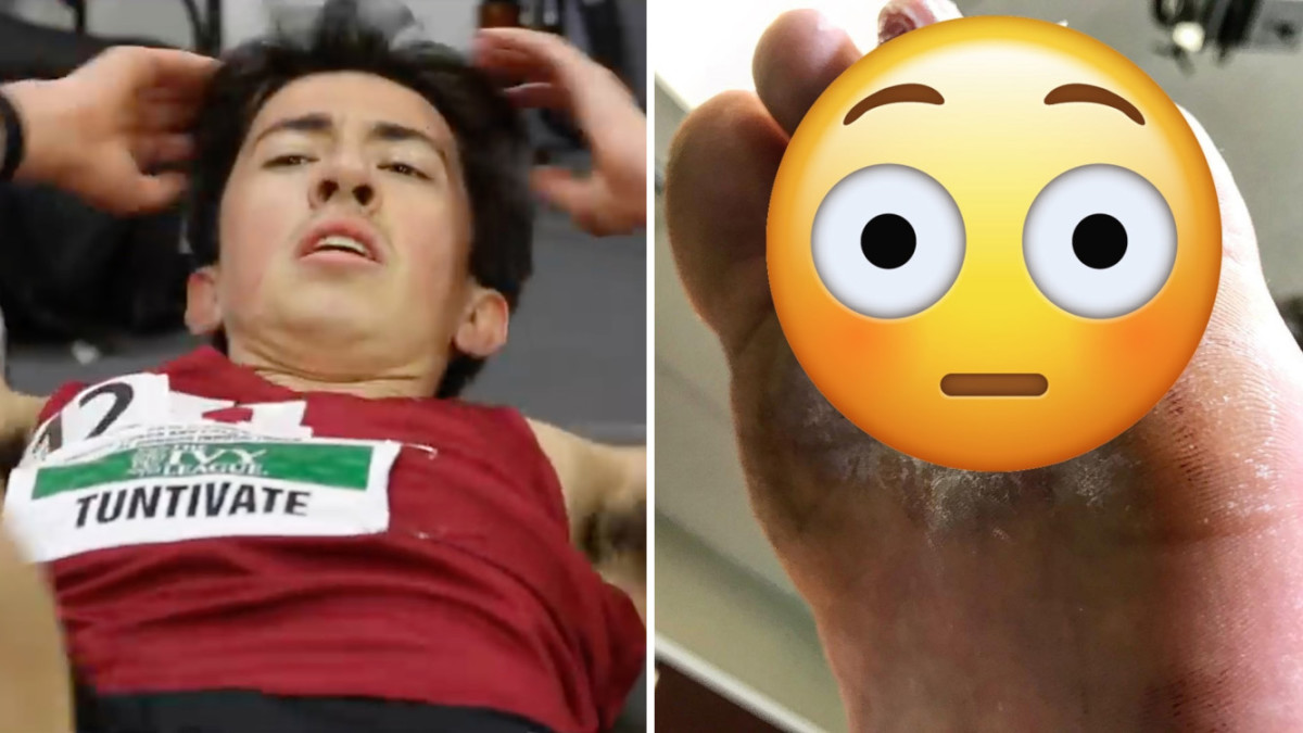 friday-hot-clicks-harvard-runner-kieran-tuntivate-foot-injury-photo.jpg